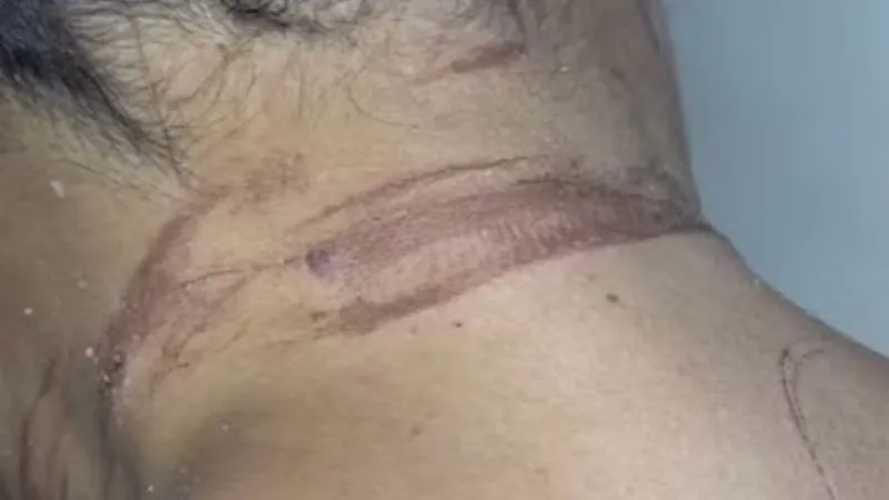 Mulher sobrevive após ser estrangulada e enterrada viva pelo ex-namorado na Bahia